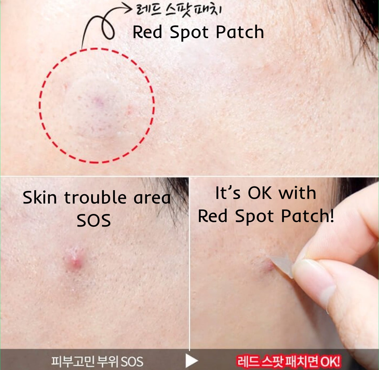 Holika Holika Acne Care Mild Red Spot Patch, 12 pcs